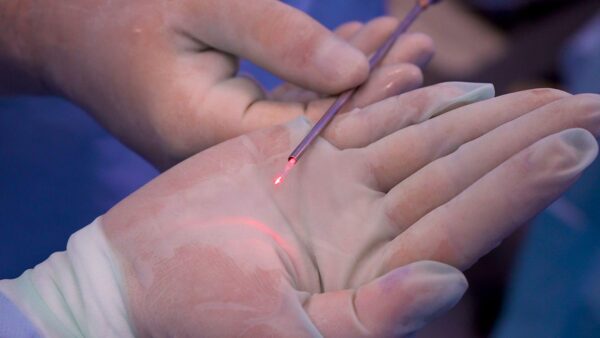 Instrumento cirúrgico com laser sendo utilizado durante procedimento